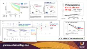 LDR brachytherapy for prostate cancer trial results